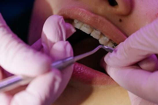 Best Dental Hygienist Schools in New York