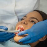 Kavitet vs tandförfall